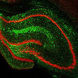 Fluorescently stained hippocampus